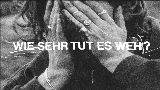 Video küçük resmi Wie sehr tut es weh?