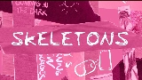 Video küçük resmi Skeletons